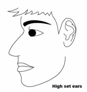 High-set Ears in Chinese face reading
